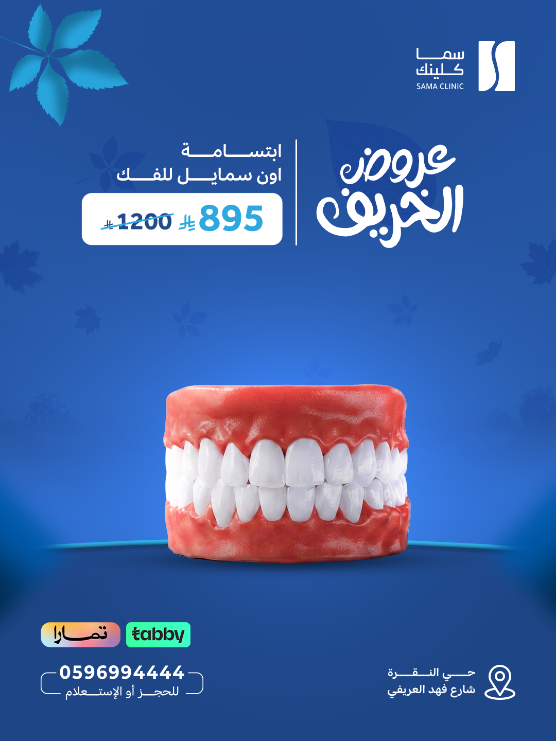 ابتسامة اون سمايل للفك