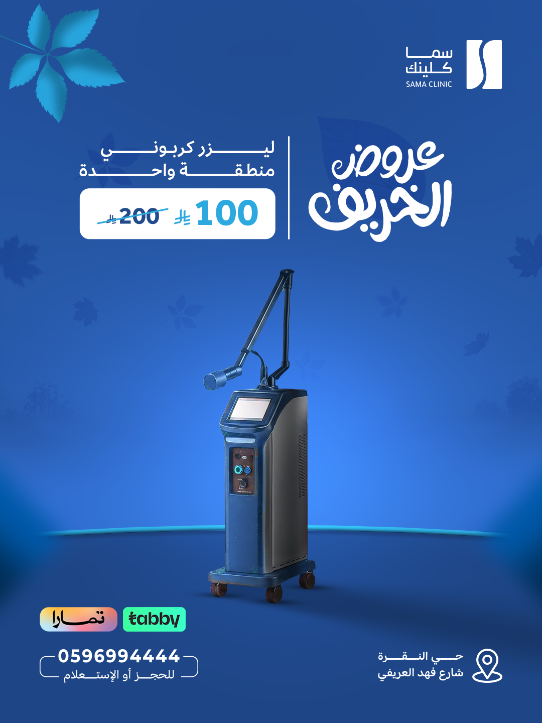 ليزر كربوني – منطقة واحدة