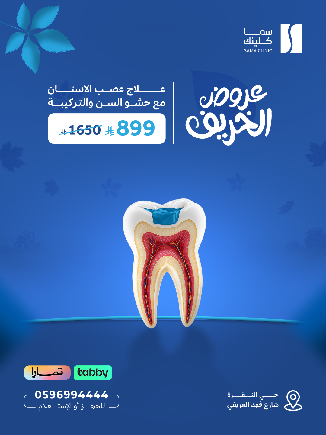 علاج عصب الاسنان مع حشو السن والتركيبة