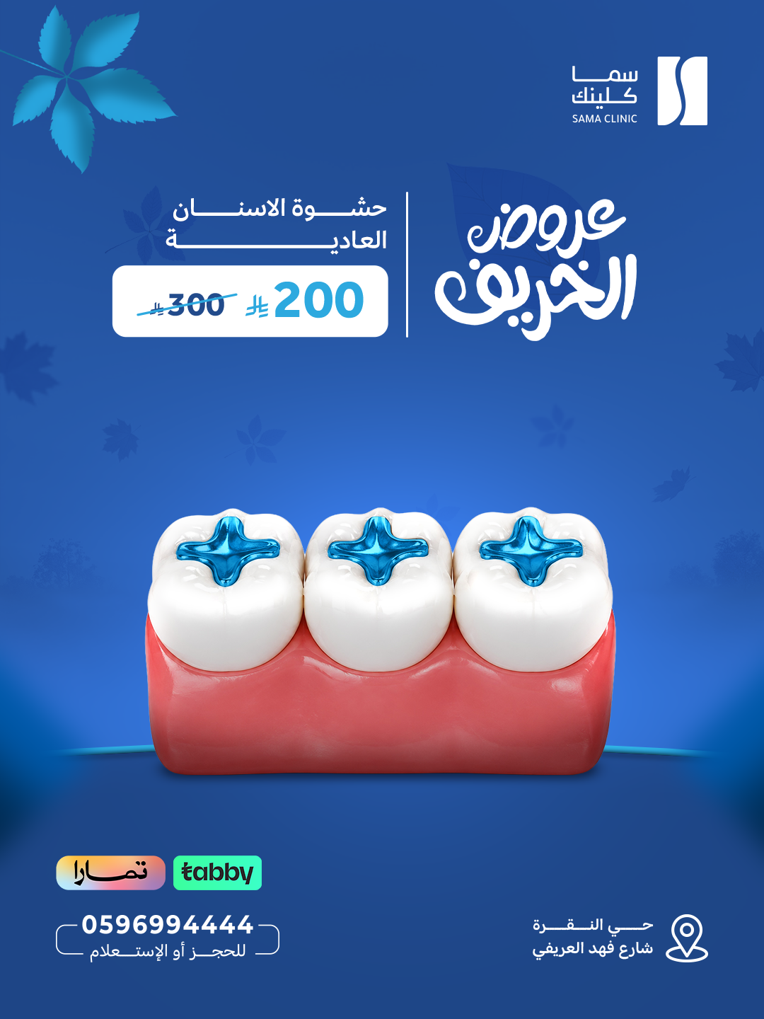 حشوة الاسنان العادية