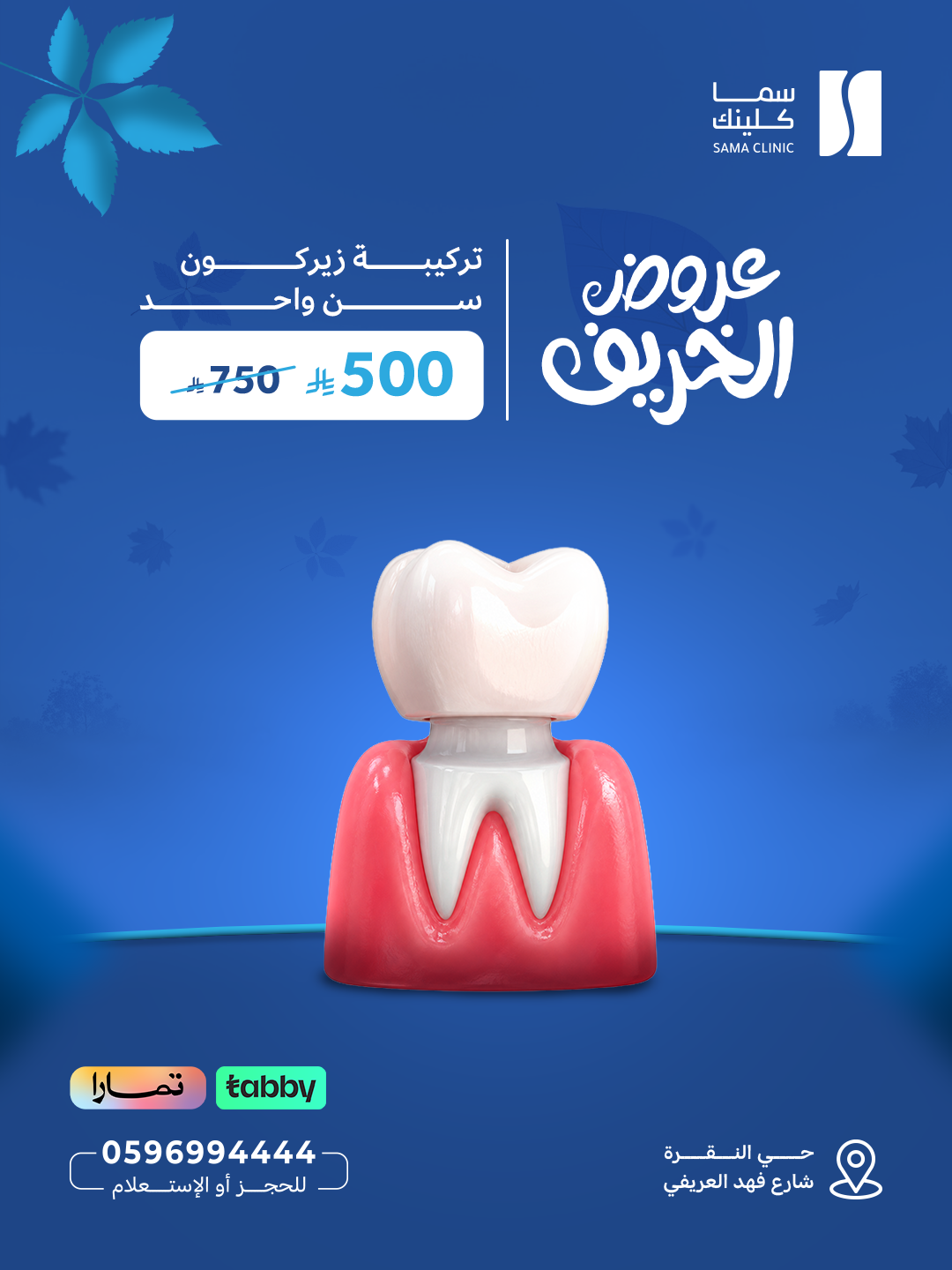 تركيبة زيركون سن واحد